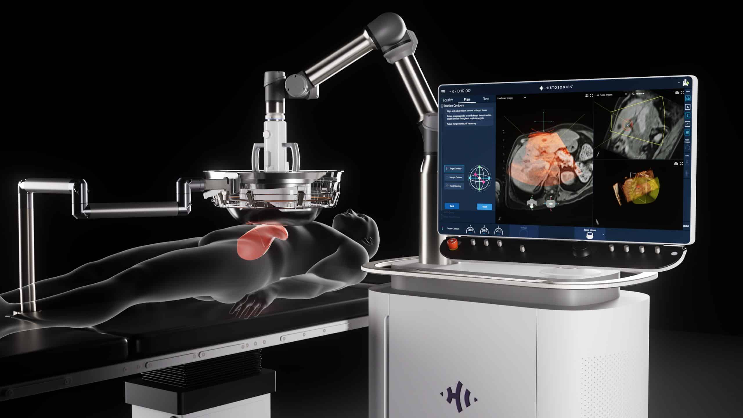 MEET EDISON: Non-Invasive Tumor Destruction